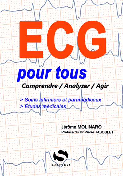 L´ECG POUR TOUS