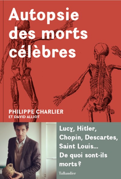 AUTOPSIE DES MORTS CELEBRES