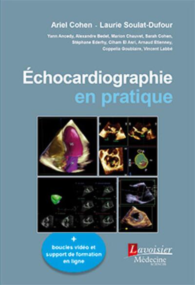 ECHOCARDIOGRAPHIE EN PRATIQUE