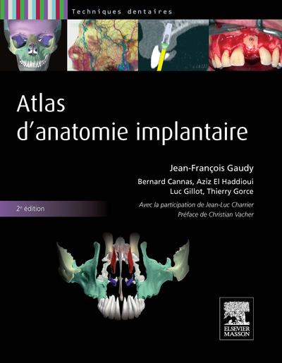 ATLAS D´ANATOMIE IMPLANTAIRE