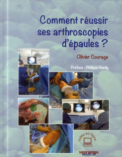 COMMENT REUSSIR SES ARTHROSCOPIES D EPAULE