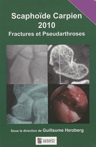 SCAPHOIDE CARPIEN 2010 FRACTURES ET PSEUDOARTHROSES
