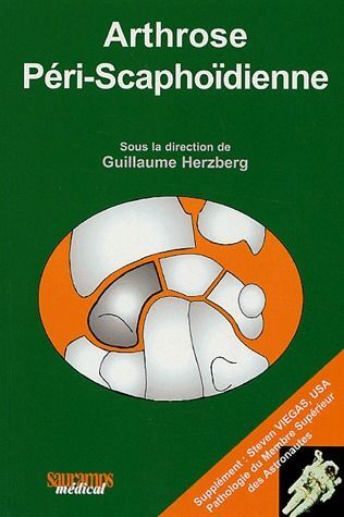 ARTHROSE PERI SCAPHOIDIENNE