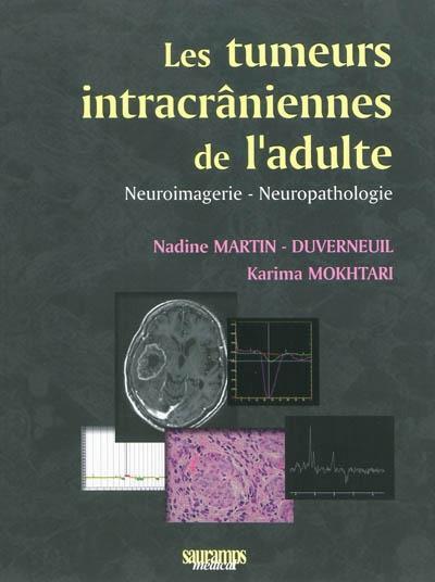 TUMEURS INTRACRANIENNES DE L ADULTE