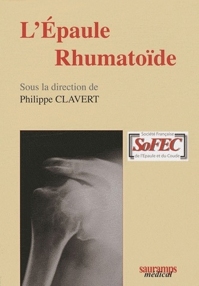 EPAULE RHUMATOIDE
