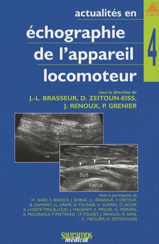 ACTUALITES EN ECHOGRAPHIE DE L APPAREIL LOCOMOTEUR TOME 4