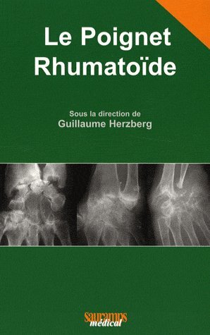 POIGNET RHUMATOIDE