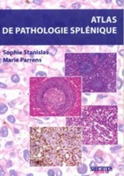 ATLAS DE PATHOLOGIE SPLENIQUE