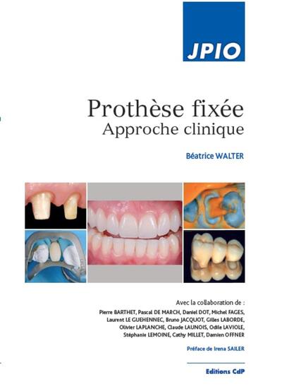 PROTHESE FIXEE - APPROCHE CLINIQUE