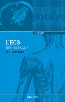 L´ECG RENDU FACILE 2ED