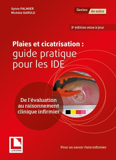 PLAIES ET CICATRISATION : GUIDE PRATIQUE POUR LES IDE - DE L´EVALUATION AU RAISONNEMENT CLINIQUE INF
