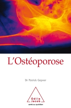 OSTEOPOROSE