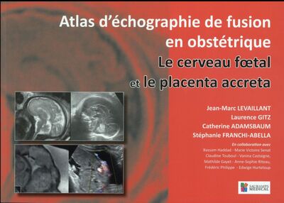 CERVEAU FOETAL ET LE PLACENTA ACCRETA. ATLAS D ECHOGRAPHIE DE FUSION EN GYNEC
