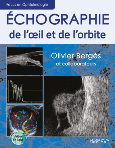 ECHOGRAPHIE DE L OEIL ET DE L ORBITE