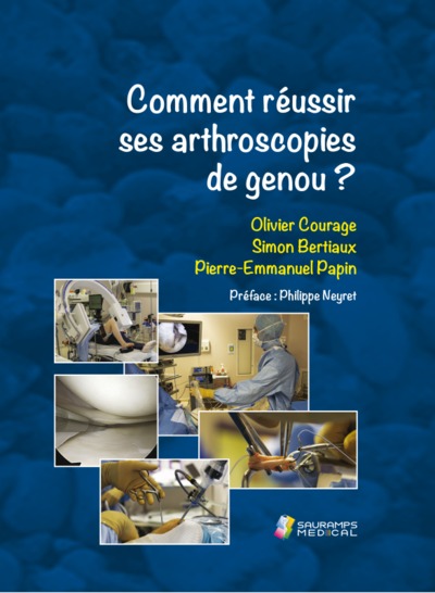 COMMENT REUSSIR SES ARTHROSCOPIES DE GENOU ?