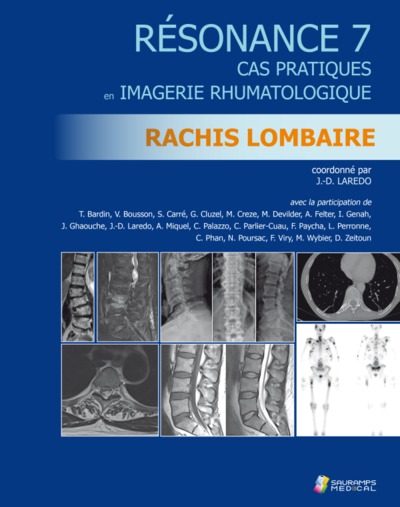 RESONANCE 7 - RACHIS LOMBAIRE - CAS PRATIQUES  IMAGERIE RHUMATOLOGIQUE
