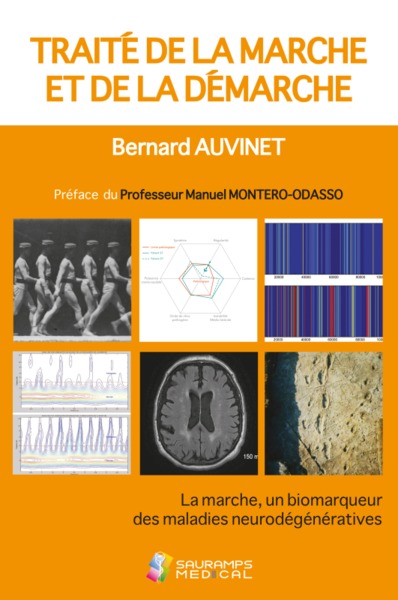 TRAITE DE LA MARCHE ET DE LA DEMARCHE - LA MARCHE, UN BIODEMARQUEUR DES MALADIES NEURODEGENERATIVES