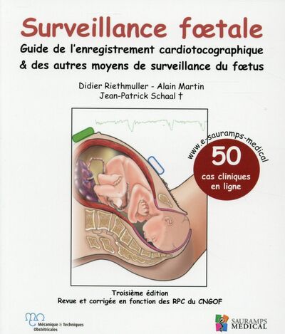 SURVEILLANCE FOETALE - GUIDE DE L´ENREGISTREMENT CARDIOTOCOGRAPHIQUE & AUTRES MOYENS DE SURVEILLANCE