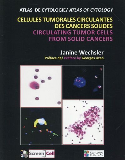 CELLULES TUMORALES CIRCULANTES DES CANCERS SOLIDES - CIRCULATING TUMOR CELLS FROM SOLID CANCERS